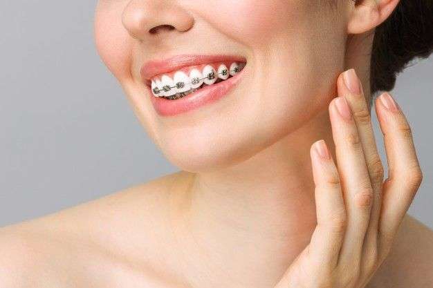 Orthodontics for Adults in Mississauga, ON: Why It’s Never Too Late for a Straighter Smile