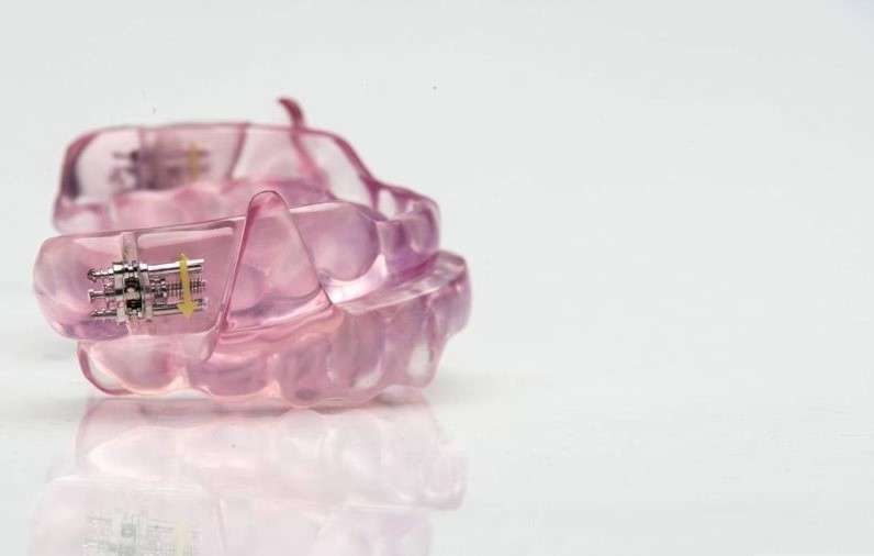 SomnoMed oral appliance device used for sleep apnea therapy and treatment.