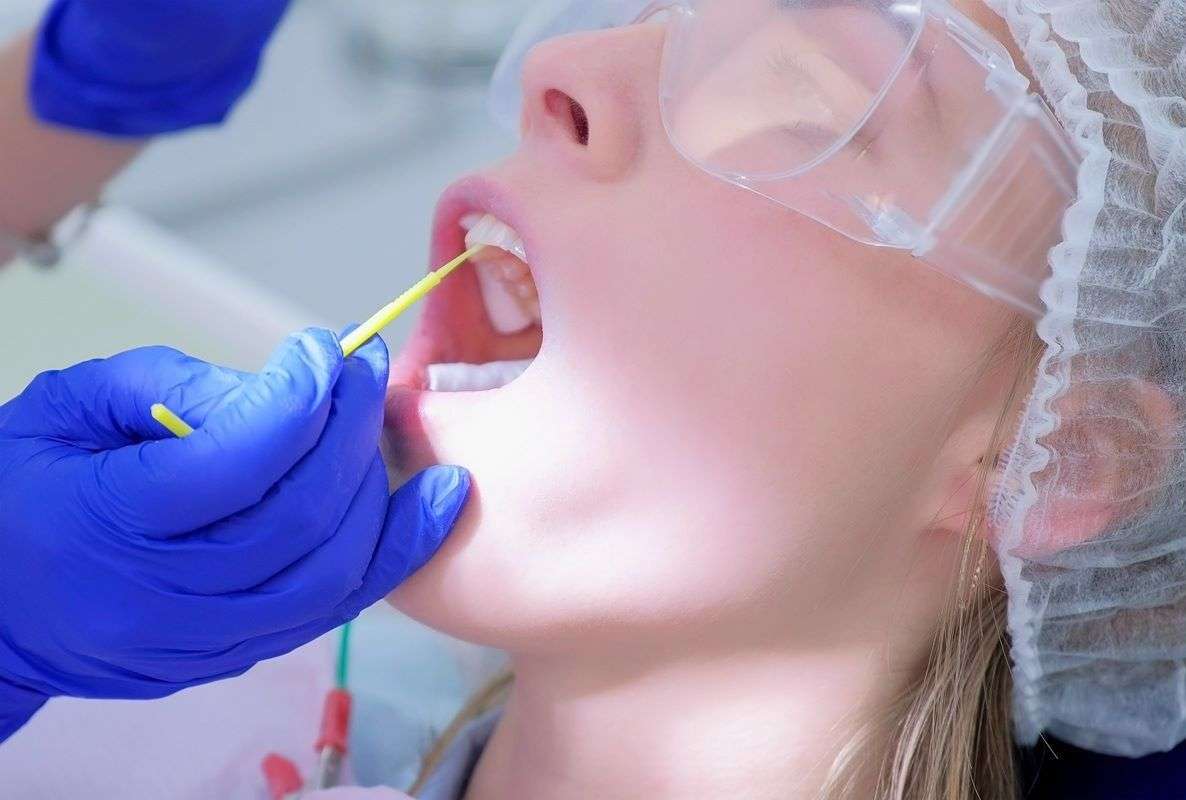 Fluoride Treatment in Mississauga: Your Complete Guide to a Healthier Smile