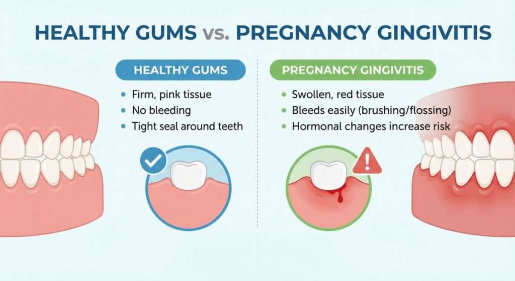 pregnancy-gingivitis-prevention-mississauga