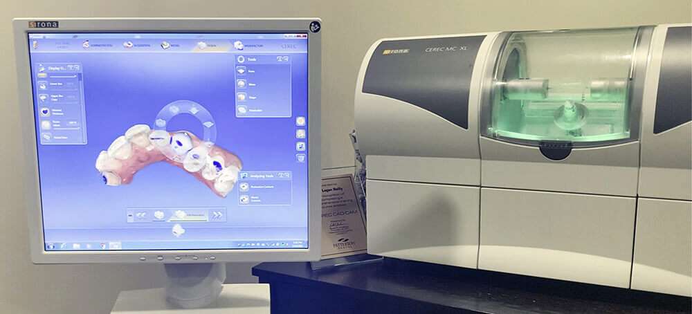 7 Biggest Benefits of Same-Day Crowns with CEREC Technology in Mississauga, ON